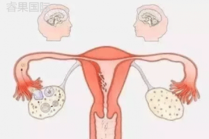 试管孕妈别紧张!生化妊娠并非“坏事”——原因解析与应对建议