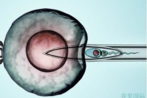 第三代试管婴儿胚胎移植后的全面解析