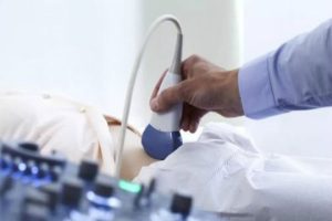 试管婴儿胚胎移植后出现出血正常吗?