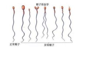 胚胎移植后的第nn天,hCG水平达到多少才算成功着床?