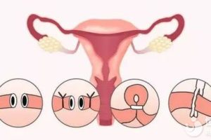 试管婴儿失败后,多久可以再次尝试?主要取决于这两点!