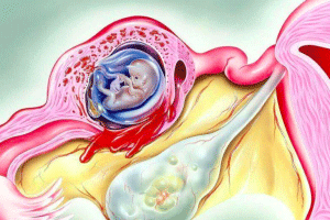 试管成功经验分享:两次移植后怀孕的心得体会(专业优化版)