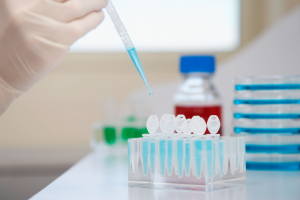 泰国试管婴儿胚胎移植后出血是否正常?分阶段解析原因及应对建议