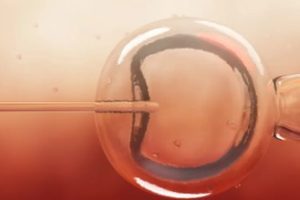 泰国试管婴儿移植后出现出血该怎么办?