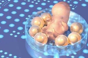 胚胎移植后的常见感受及应对策略