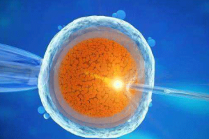 胚胎移植:试管婴儿成功的关键环节,全流程及护理要点一文解析