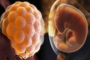 试管婴儿胚胎移植时应注意的事项