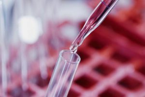 高龄女性进行试管婴儿(IVF)时,必须注意以下六个关键点!