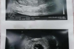 中国有哪些医院提供优质的宫腔内人工授精服务?高成功率医院推荐