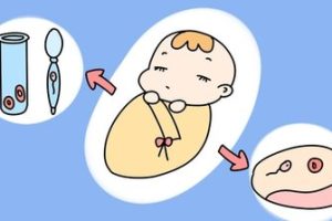 人工授精的费用明细与成功率的主要影响因素(科普版)