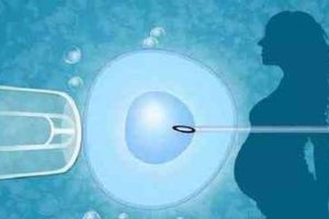 宫腔内人工授精(IUI)成功的早期迹象有哪些?费用大致在多少