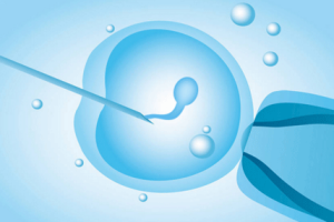 人工授精(IUI)与试管婴儿(IVF):成功率、差异及适合的