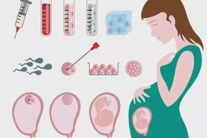 试管婴儿过程中精子提取的注意事项:准爸爸必读的要点