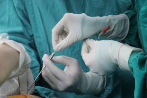 在进行试管婴儿时,可以提前采集精子保存备用吗?