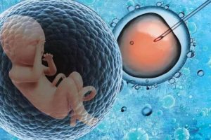 试管婴儿取精方法的选择:显微取精与常规取精,哪一种更适合您?