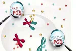 试管婴儿男性精子采集指南:流程、注意事项及准备全攻略