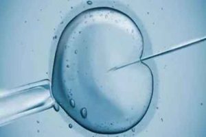 试管婴儿过程中的穿刺取精会不会很痛?本文将消除你的疑虑