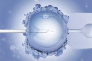 试管婴儿取卵后出现腹水该怎么办?全面应对方案指南