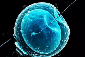 哪些因素会影响卵子的提取数量?