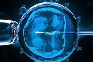 试管婴儿取卵痛吗?这篇文章将帮助你消除疑虑