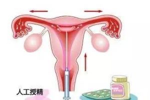 试管婴儿取卵指南:重要步骤与常见问题解答