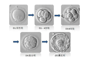 试管婴儿取卵会疼吗?整体流程及注意事项一文详解
