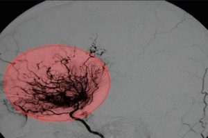 试管婴儿的取卵过程会很疼吗?