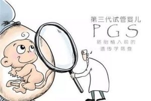 试管婴儿取卵手术的全面指南:流程、术后反应及注意事项