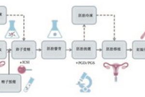 试管婴儿取卵:是否会感到疼痛?全面解读经阴道取卵的流程和注意