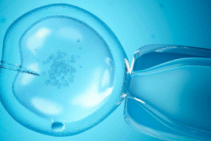 试管婴儿取卵的完整流程指南