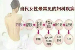 试管婴儿取卵全流程指南:关键步骤详解