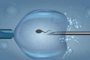 试管婴儿取卵全方位指南:流程解析与重要注意事项