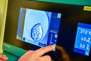 试管婴儿取卵是否会感到疼痛?