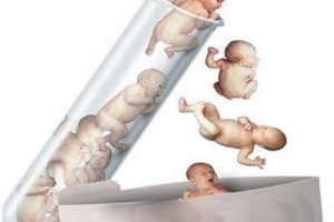 短周期试管婴儿方案能够获取多少个卵子?