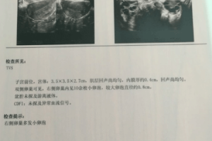 试管婴儿促排卵:饮食建议与科学基础