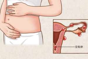 试管婴儿促排卵未获取成熟卵泡时的应对方案