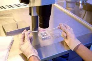 为什么别人的卵泡生长得比我快?