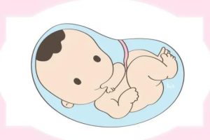 巧克力囊肿:每三名不孕女性中就有一名可能与之相关?需注意这些