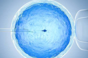 试管婴儿微刺激方案:适合这三种人群,四大优势十分明显!