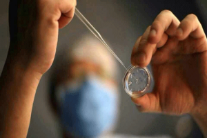 试管婴儿拮抗剂方案:优势分析及与其他方案的比较