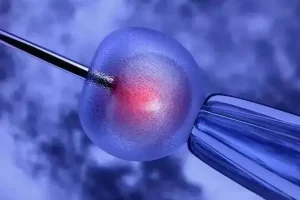 试管婴儿中使用拮抗剂方案的卵子质量怎么样?