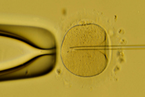 泰国试管婴儿(IVF)基础检查项目