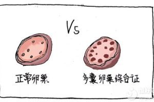 夫妻双方常见的检查项目及其注意事项