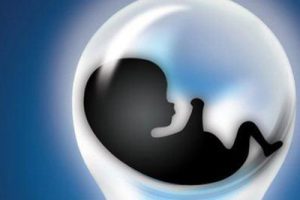 做试管婴儿是否一定要进行宫腔镜检查?