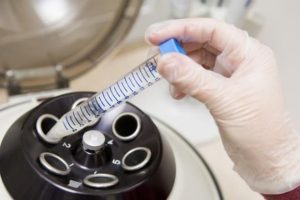 试管婴儿前需要检查宫颈癌吗?