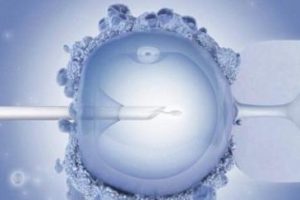 试管婴儿检查时间指南:月经与非月经期,这些细节需牢记