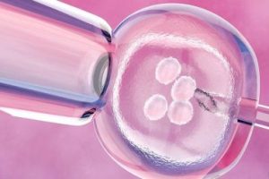 试管婴儿男性检查:每一项都不可或缺!