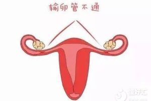 进行试管婴儿前需要进行哪些检查?