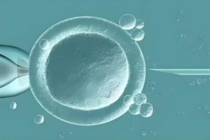 您知道试管婴儿之前必须进行的三个重要检查吗?