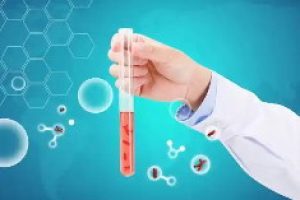 在进行试管婴儿时,宫腔镜检查应该在什么时间进行?